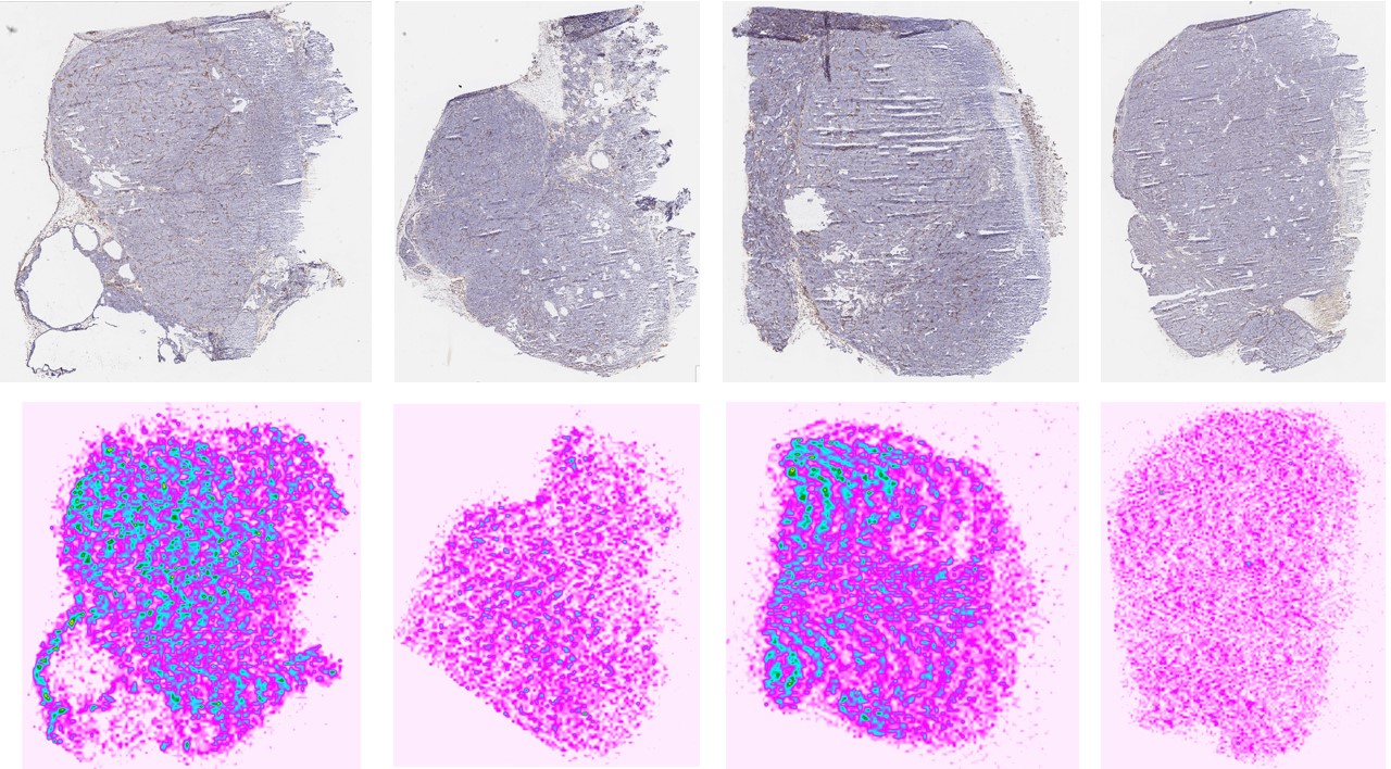 Paclitaxel mass spec imaging in solid tumor tissue